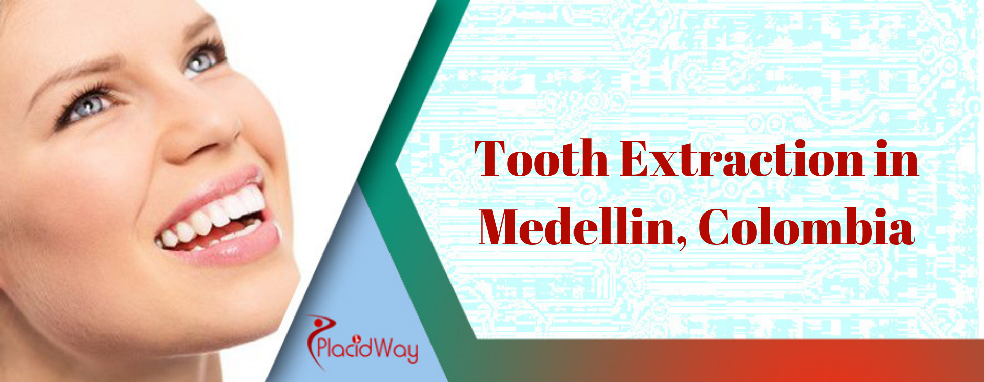 Tooth Extraction in Medellin, Colombia